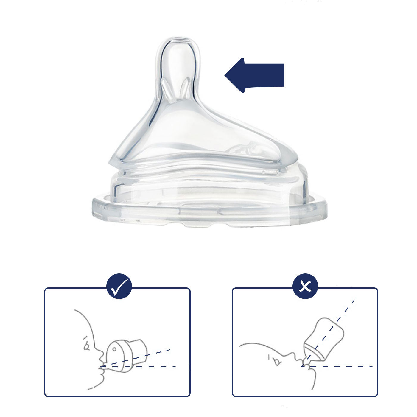 Newborn Teat, Natural Teat Latching, Bottle Nipple, Bottle Teat