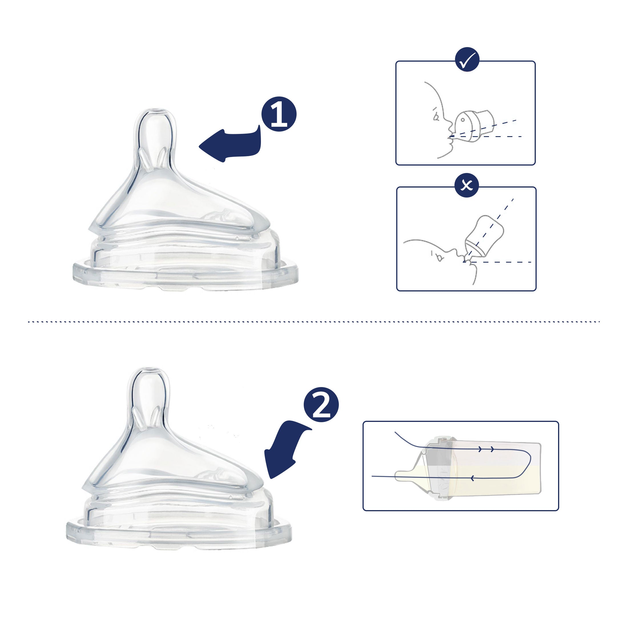Anti Colic Teat, Prevent Gassy Stomach